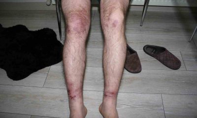 Yaş betona dokununca olanlar oldu