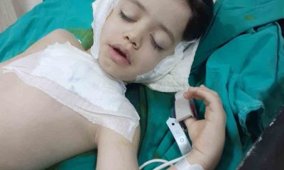 4 yaşındaki çocuğun 7 ameliyat sonrası kulağının çürüdüğü iddiasıyla ilgili açıklama: