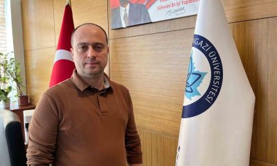 Yirmilik diş çekimi konusunda uzmanlar uyarıyor