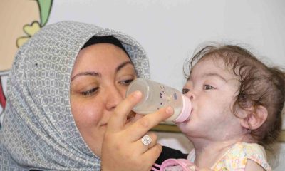 Doğduktan 1 gün sonra ameliyata alınan bebek sağlığına kavuştu
