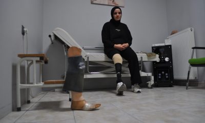 Kırık protezini bantlayıp çalışarak 4 çocuğuna bakan fedakar anne