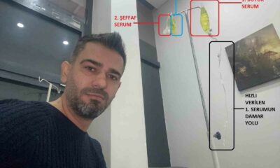 Sarı serum faciasının altından diploması iptal edilen doktor çıktı