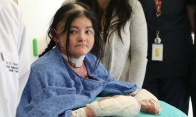 Amerikalı Ledesa’nın parmakları evinden 9 bin 930 kilometre ötedeki Eskişehir’de açıldı