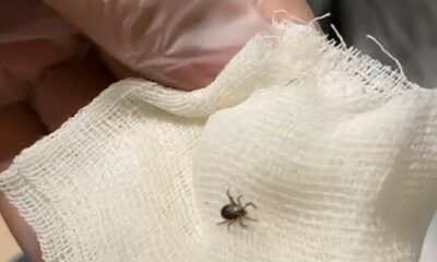 Eskişehir’de kene paniği hastanede bitti