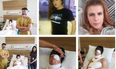 Genç kadının hayatı kezzapla karardı