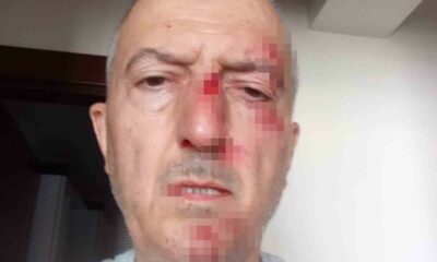 Önce icra yoluyla evinden tahliye edildi, ardından darp edildi
