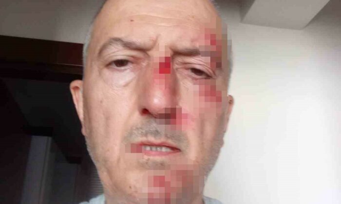 Önce icra yoluyla evinden tahliye edildi, ardından darp edildi