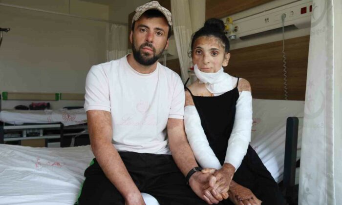Azerbaycanlı çiftin doğal gaz patlamasında kapanan elleri, 3 yıl sonunda Eskişehir’deki tedaviyle kavuştu
