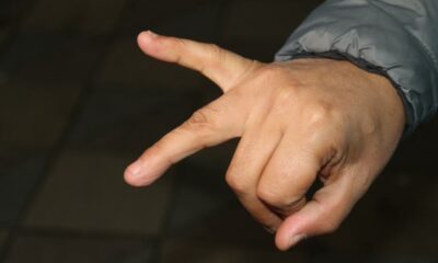 Bozuk çıkan balıkları iade etmek istedi, Darp edildi ve Parmağından oldu